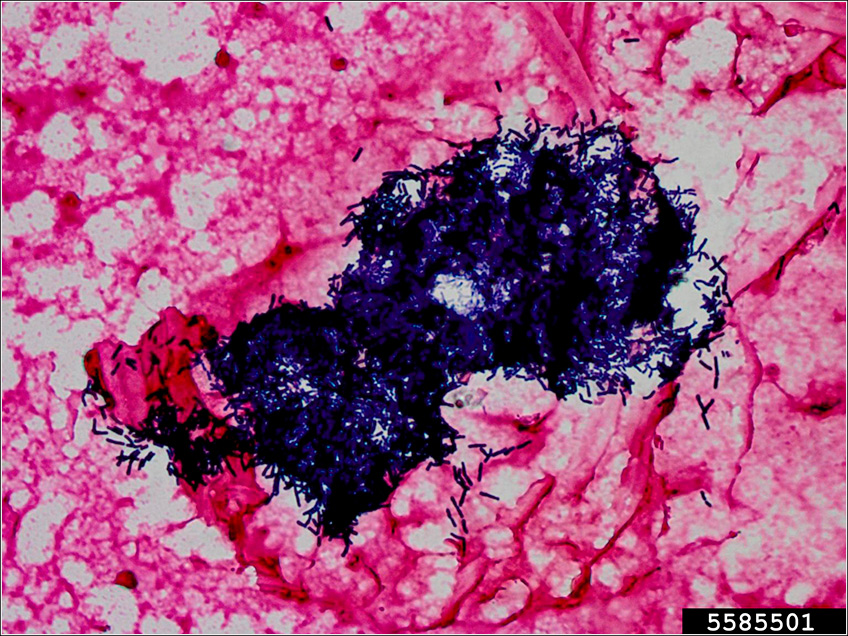 Bacillus Thuringiensis Bacillus Thuringiensis